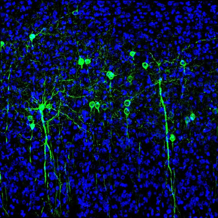 Cells from a medial prefrontal cortex